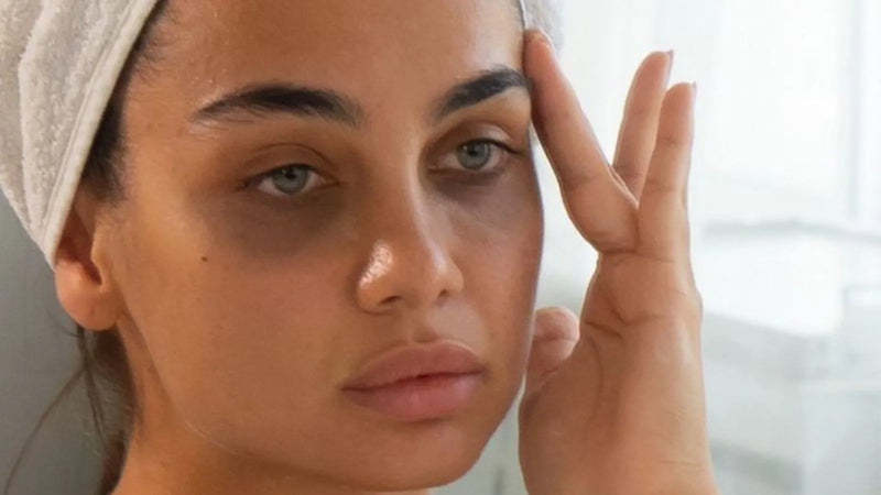Dark Circles vs. Eye Bags vs. Hollowness: How to Tell What's Causing Your Tired Look