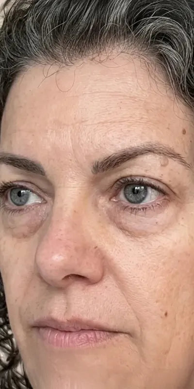 Visibly brighter under-eyes