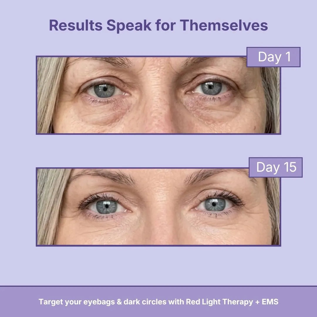LightUp Under-Eye Shades