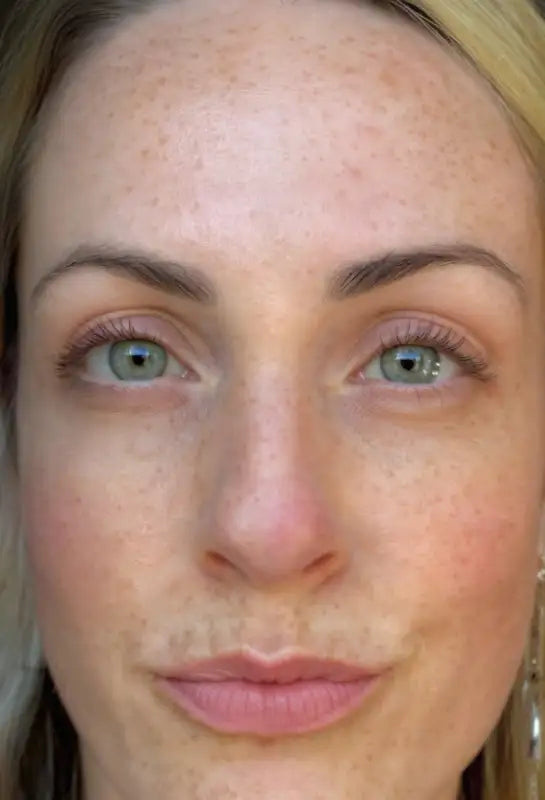 Close-up of a woman's face with freckles and green eyes. Before image (freckles).