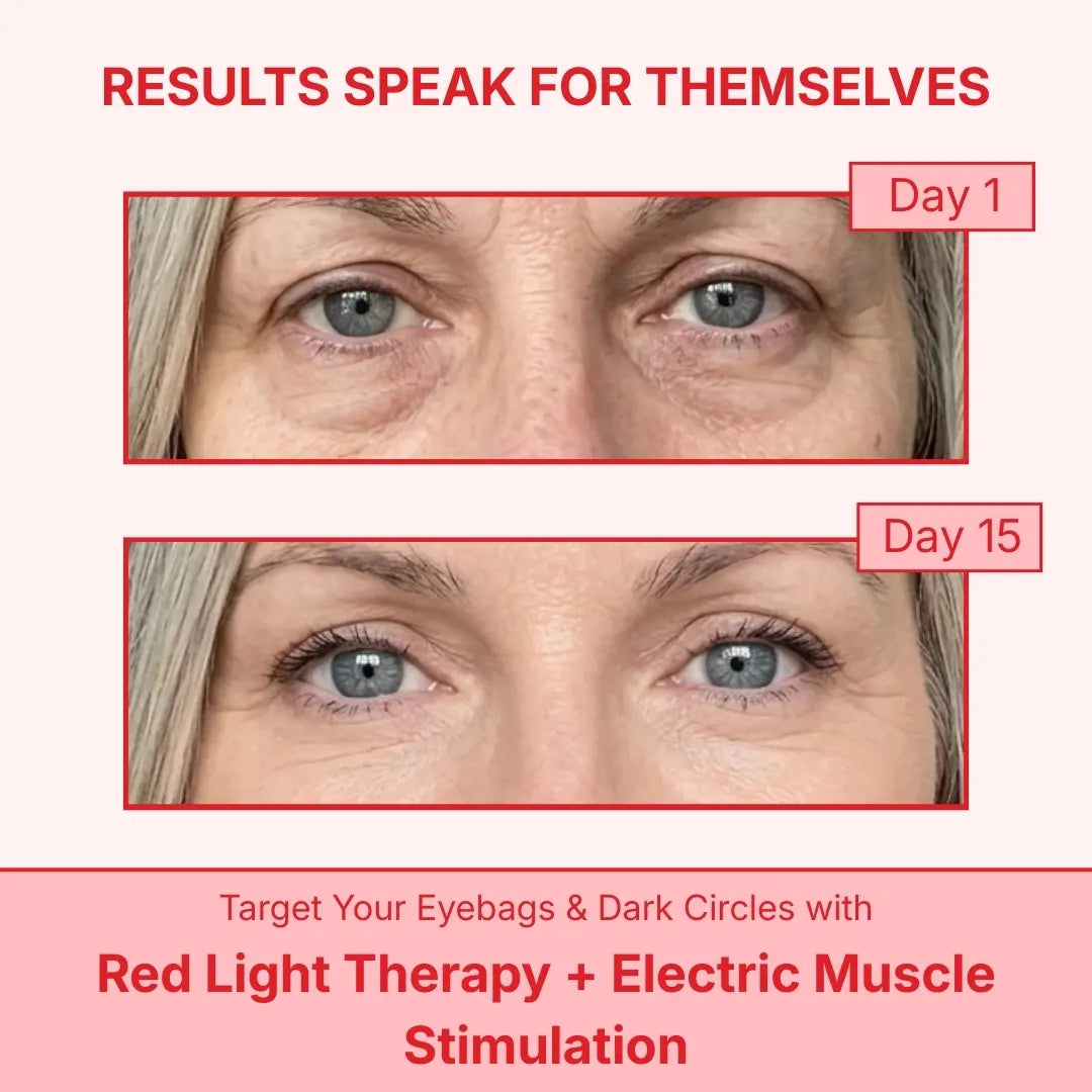 Honest Shades™ Eye Reset