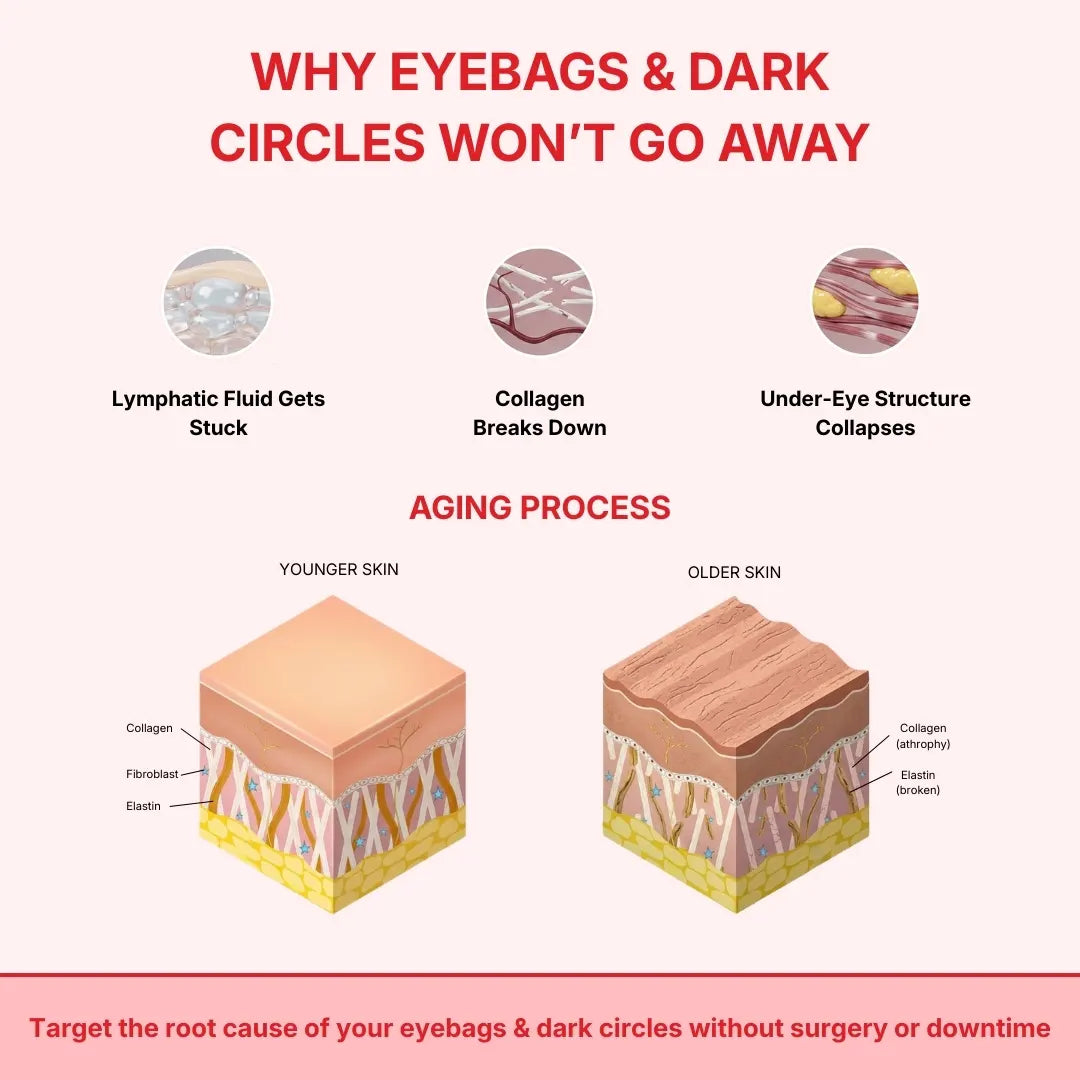 Honest Shades™ Eye Reset
